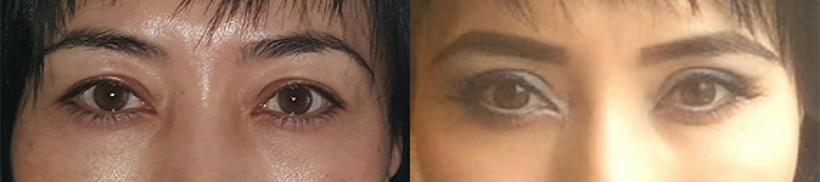 eyes08